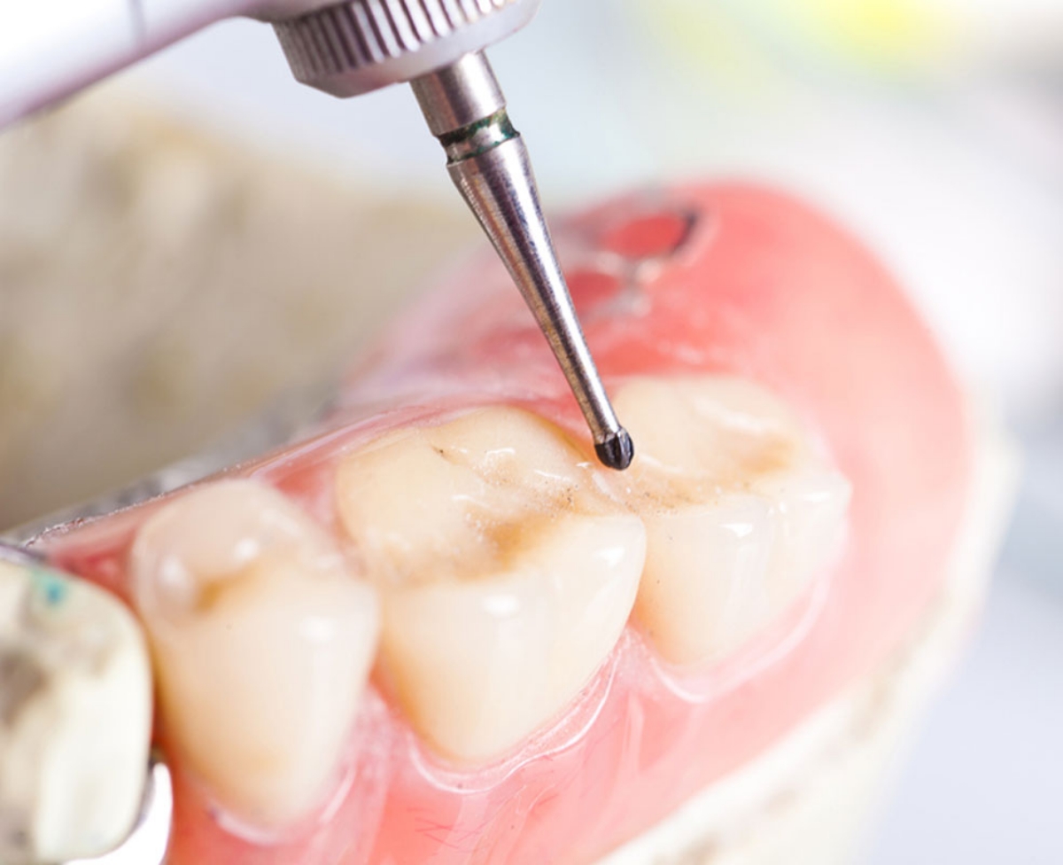 Why a healthy smile is more than just about aesthetics.